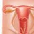 Endometrial stromal sarkom, synen på en patolog ...