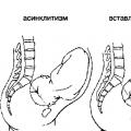 Indicații pentru epiziotomie și perineotomie